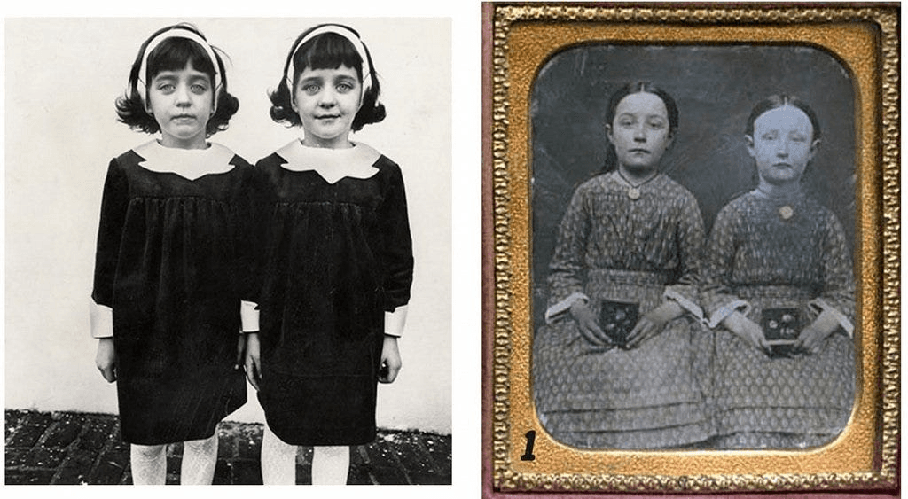The Pollock Twins – A Chilling Case of Reincarnation?